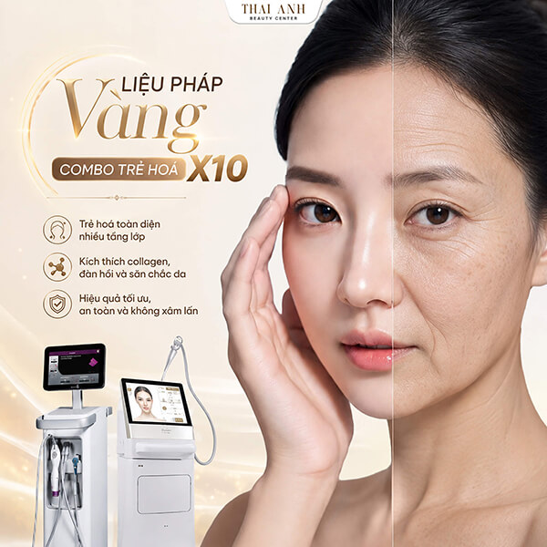 Công nghệ kết hợp tại Thái Anh
